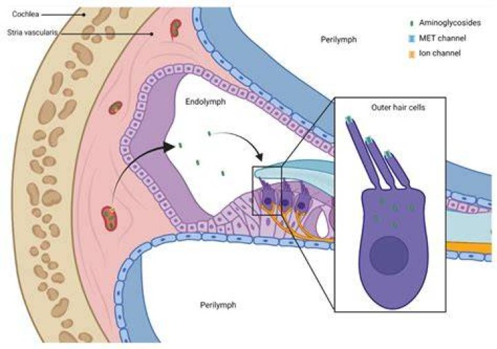 Does ototoxicity go away?